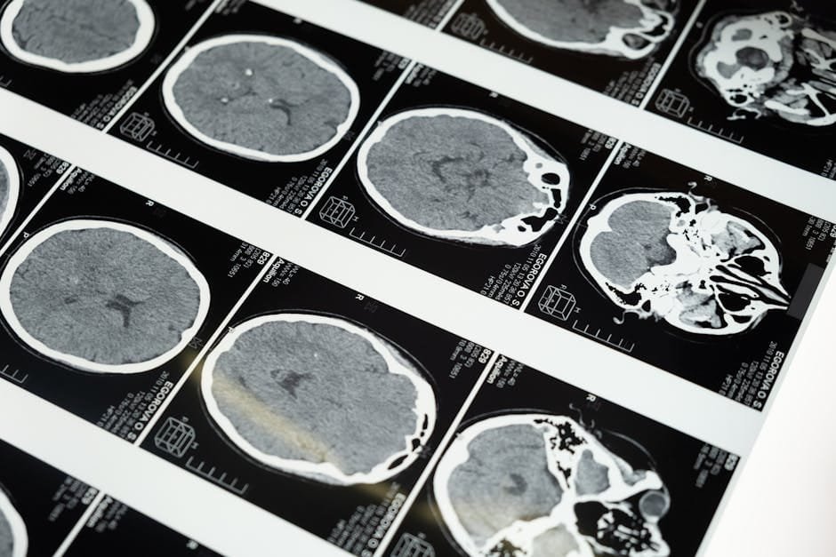 Detailed brain MRI scans displayed on a lightbox, showcasing medical imaging techniques.